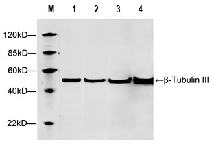 Western blot results