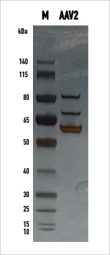 AAV 2